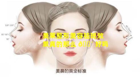 美莱整形美容祛斑效果真的那么 🌴 好吗